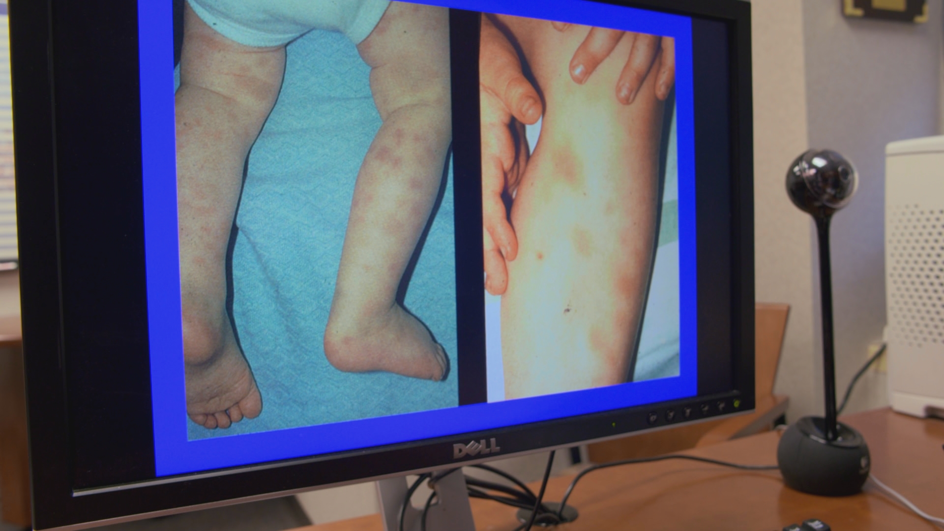 The Child Cases: 12-childlegsphoto