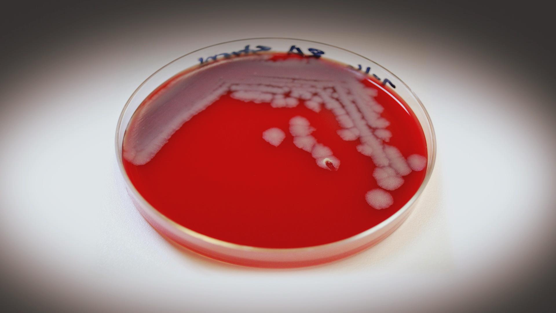 petri dish with anthrax spores