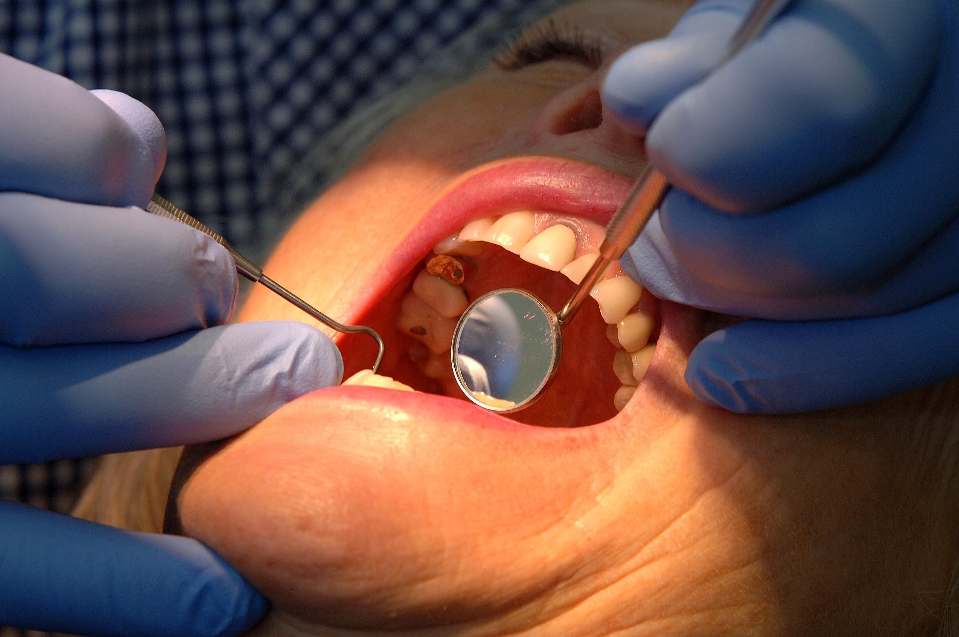 gross dental work