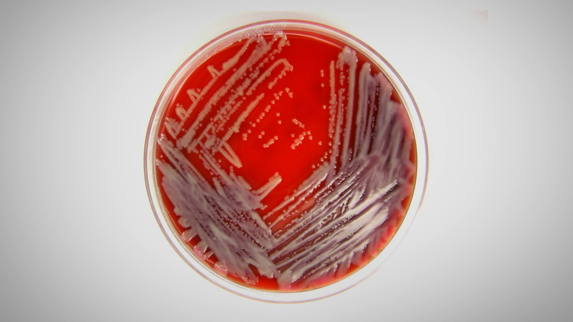 petri dish