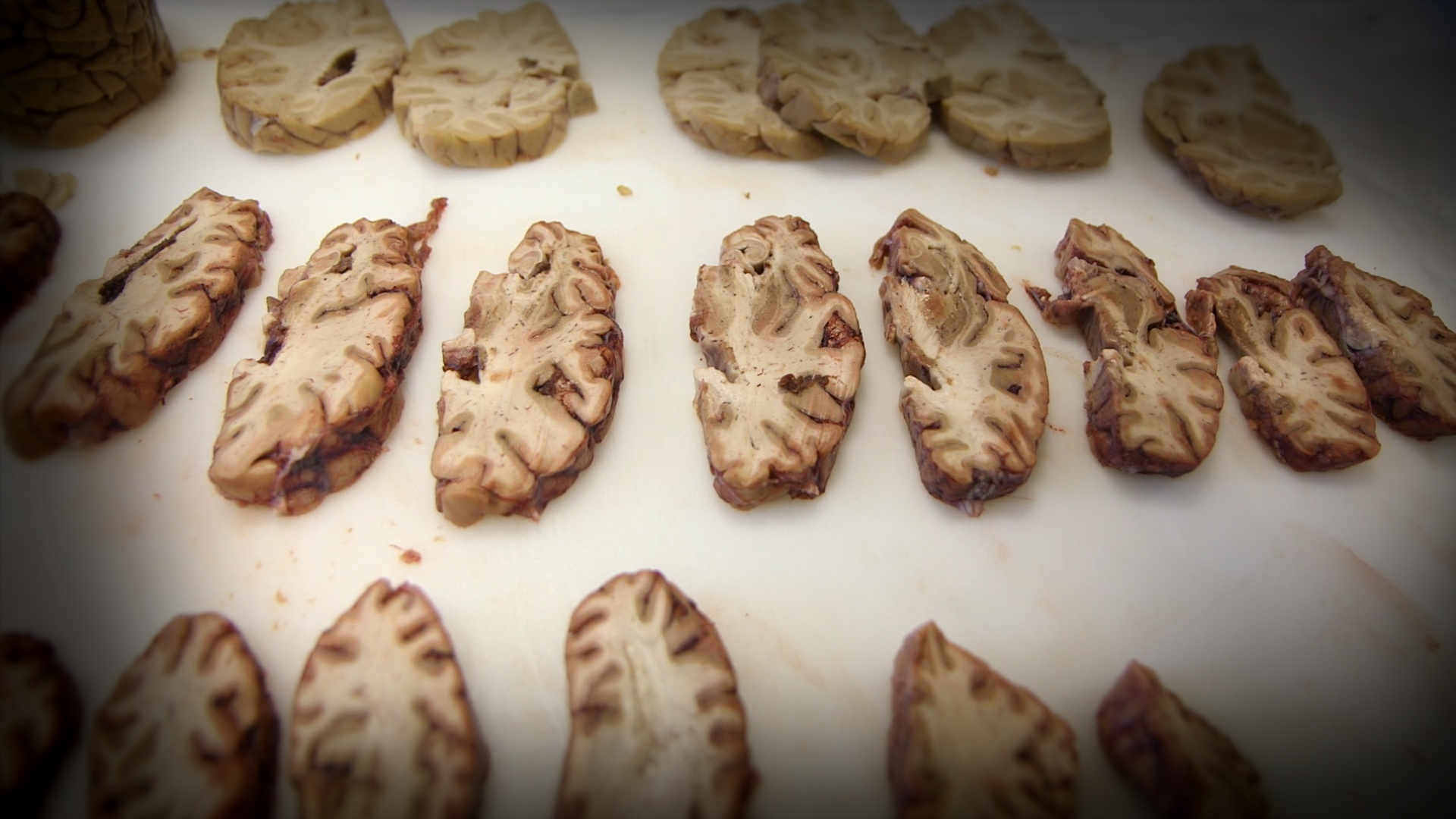 brains