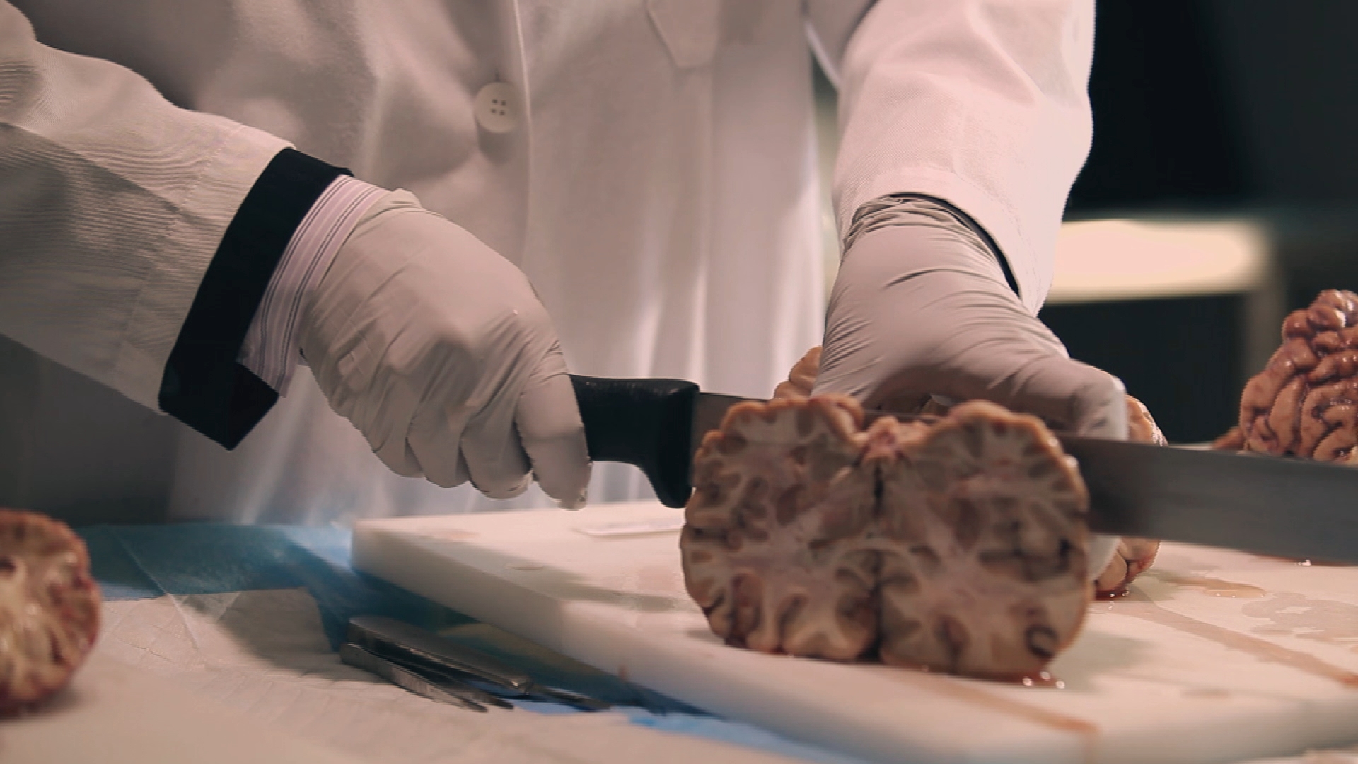 cutting brain