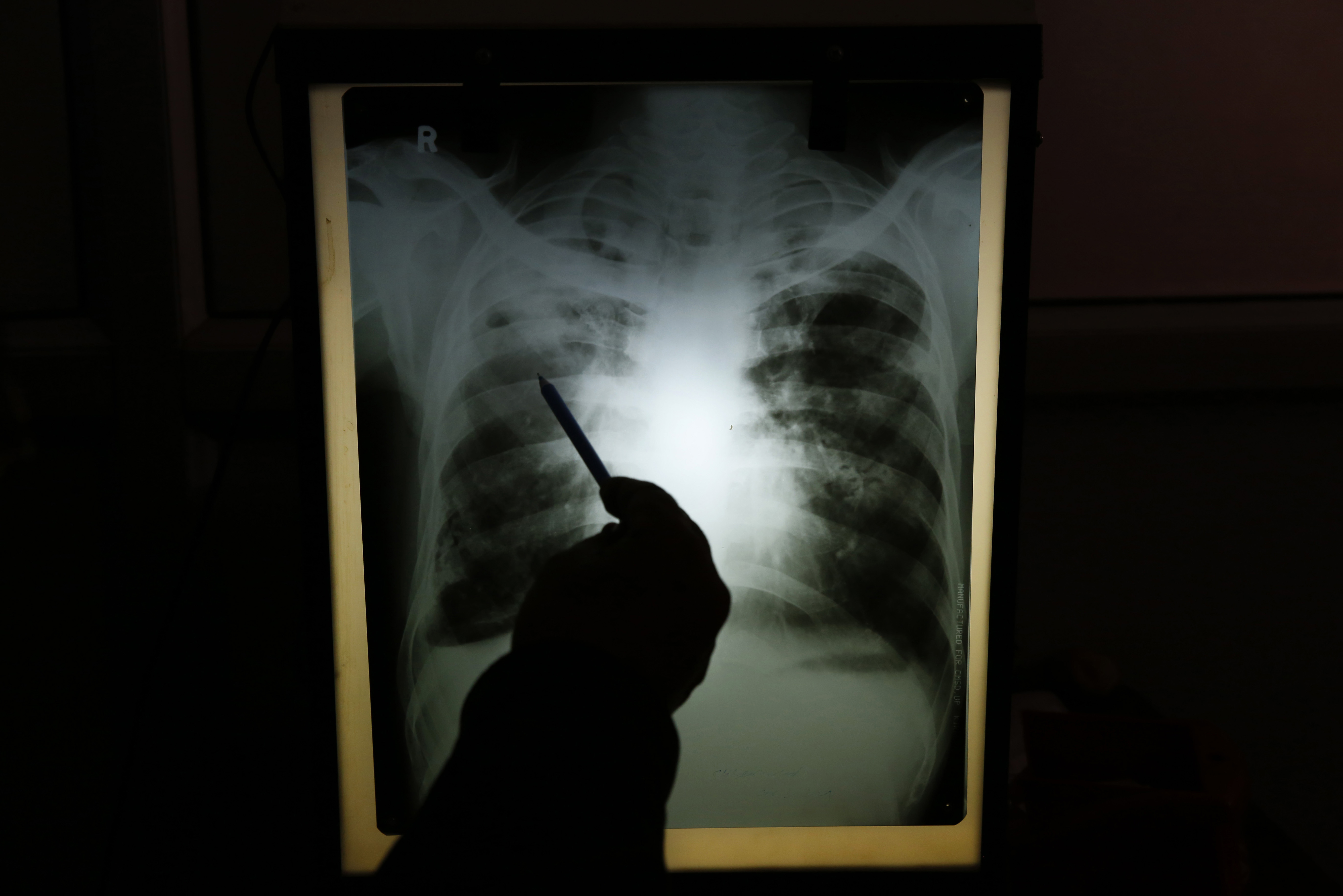 INDIA TUBERCULOSIS VILLAGES