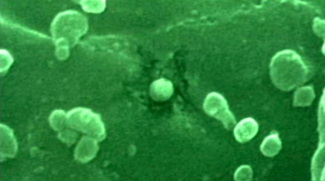 The Age of AIDS: greenvirus