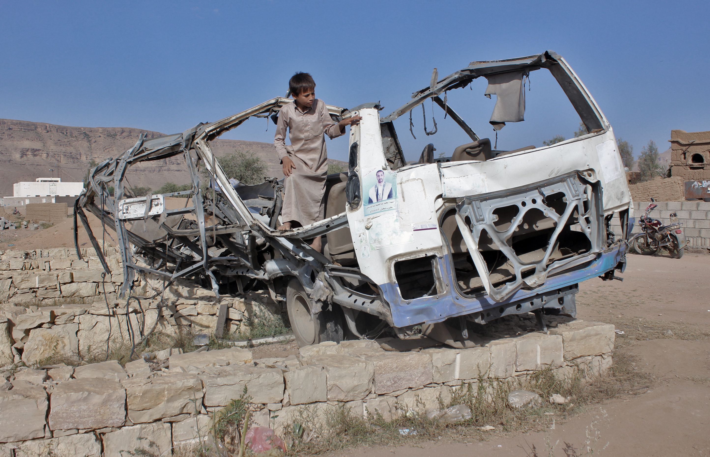 YEMEN-CONFLICT-CHILDREN