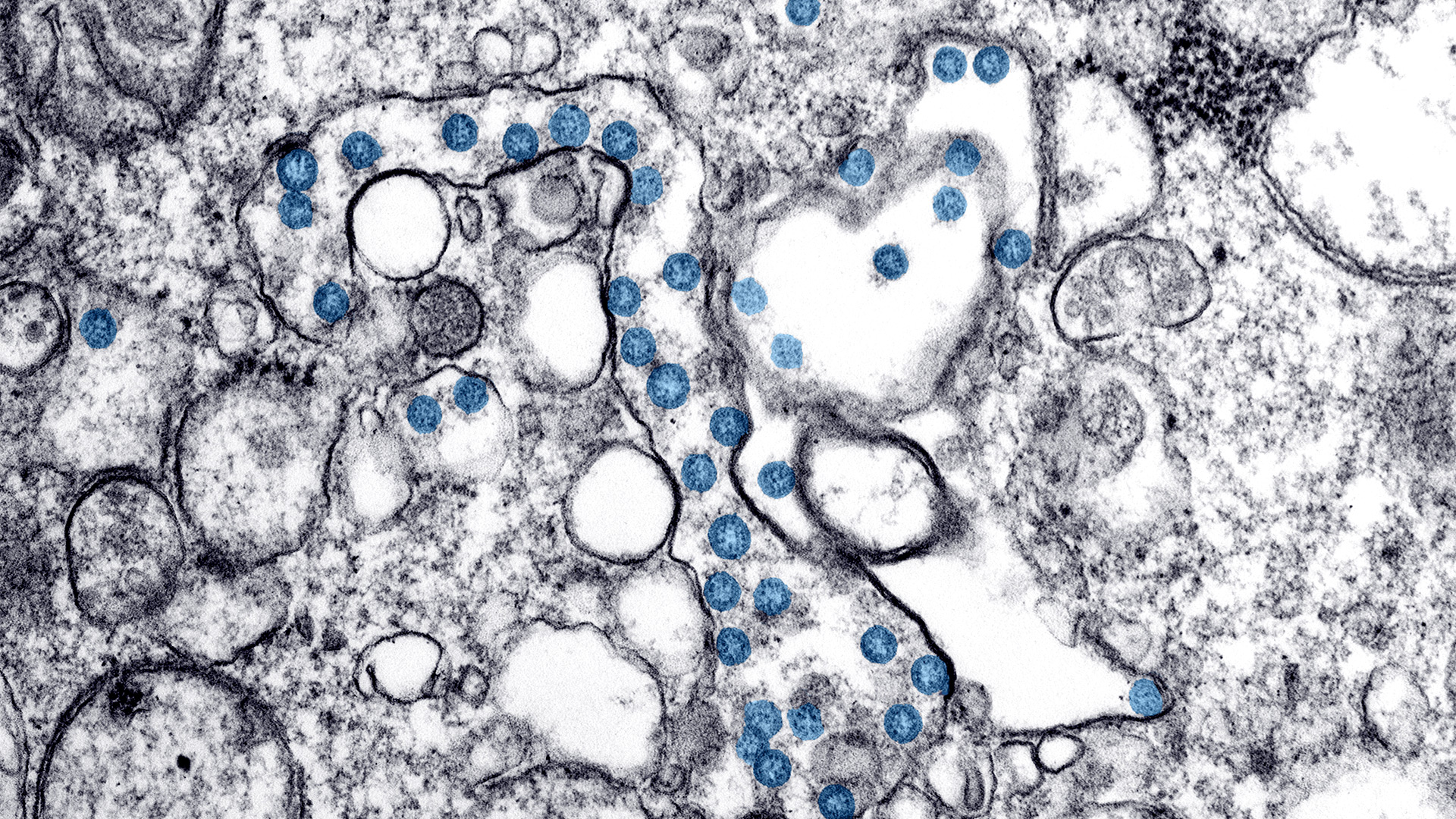 covid_microscope_cropped